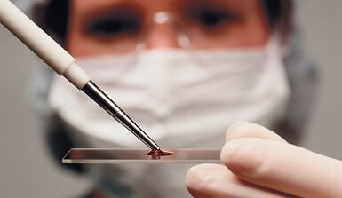 Discriminatory diagnosis of characteristic and arthrosis