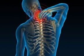Cervical osteochondrosis leads to grief in the neck