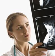 The diagnosis of osteochondrosis is specified using the X -ray exam